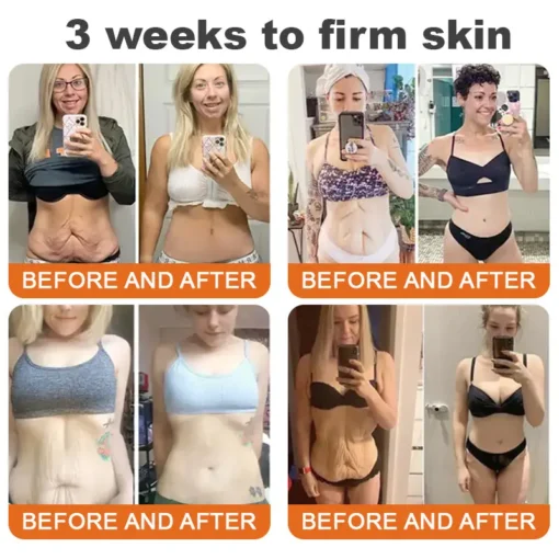 𝗔𝗣𝗟𝗢𝗣𝗥𝗘™ 𝗕𝗼𝘁𝗼𝘅 𝗕𝗲𝗲 𝗩𝗲𝗻𝗼𝗺 𝗙𝗶𝗿𝗺𝗶𝗻𝗴 𝗦𝗲𝗿𝘂𝗺 𝗦𝘁𝗶𝗰𝗸