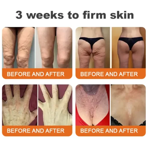 𝗔𝗣𝗟𝗢𝗣𝗥𝗘™ 𝗕𝗼𝘁𝗼𝘅 𝗕𝗲𝗲 𝗩𝗲𝗻𝗼𝗺 𝗙𝗶𝗿𝗺𝗶𝗻𝗴 𝗦𝗲𝗿𝘂𝗺 𝗦𝘁𝗶𝗰𝗸
