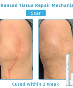 Jilvax™ ClearSkin Pen
