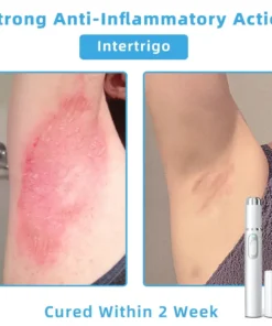 Jilvax™ ClearSkin Pen