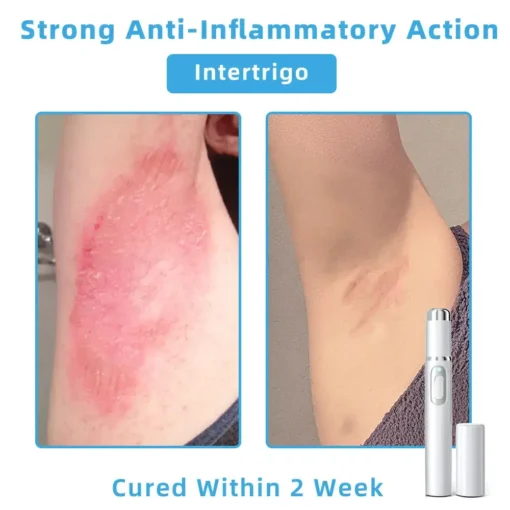 Jilvax™ ClearSkin Pen