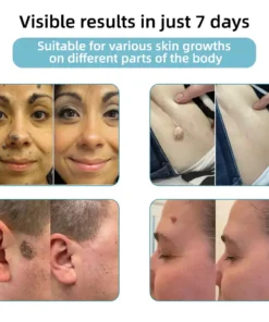 Jilvax™ ClearSkin Pen