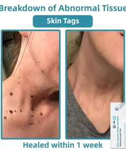 Jilvax™ ClearSkin Pen