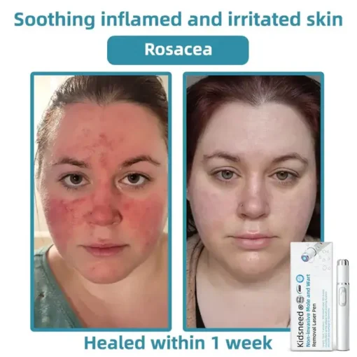 Jilvax™ ClearSkin Pen
