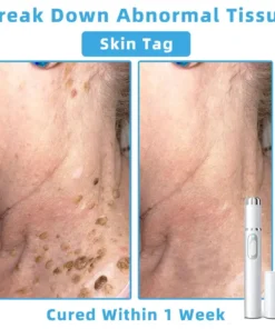 Jilvax™ ClearSkin Pen