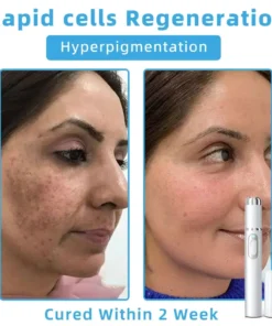 Jilvax™ ClearSkin Pen