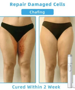 Jilvax™ ClearSkin Pen