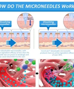 VanaSculpt® Nano Microneedle Patch: SMGT-GLP-1 & Matrixyl 3000 – Slimming, Skin Tightening, Blood Sugar Support, No Injection, 7-Day Result