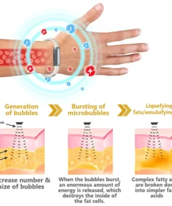 CZTICLE® FitHeal SlimTech Band