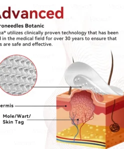 CZTICLE® Microneedles Botanical Skin Tags Solution Patches