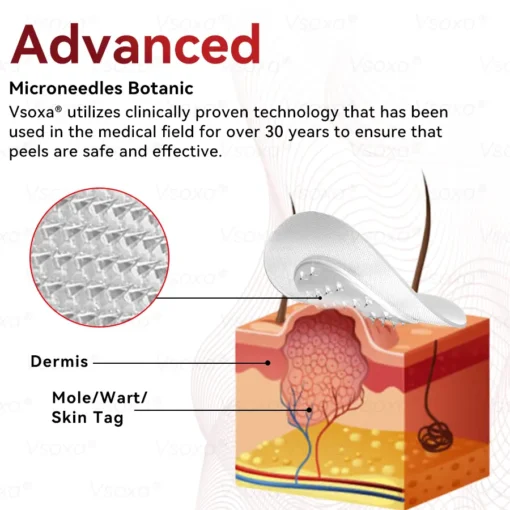 CZTICLE® Microneedles Botanical Skin Tags Solution Patches