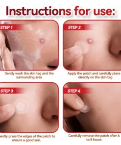 CZTICLE® Microneedles Botanical Skin Tags Solution Patches