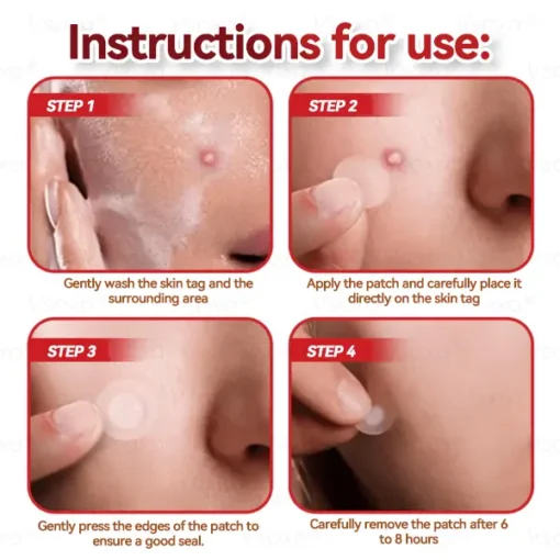 CZTICLE® Microneedles Botanical Skin Tags Solution Patches