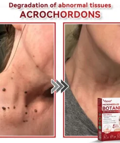 CZTICLE® Microneedles Botanical Skin Tags Solution Patches