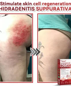 CZTICLE® Microneedles Botanical Skin Tags Solution Patches