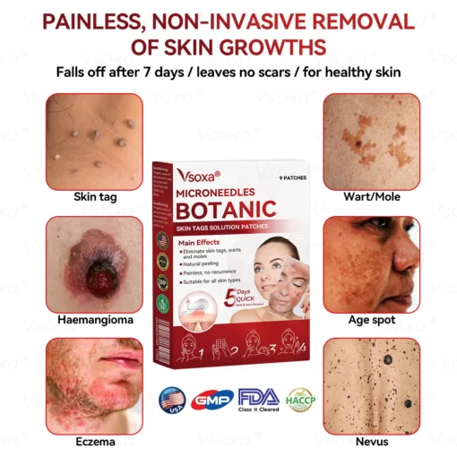 CZTICLE® Microneedles Botanical Skin Tags Solution Patches