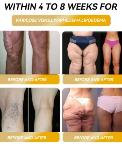 𝐂𝐙𝐓𝐈𝐂𝐋𝐄® 𝐌𝐚𝐠𝐧𝐞𝐭𝐢𝐜 𝐄𝐧𝐞𝐫𝐠𝐲 𝐆𝐞-𝐒𝐭𝐨𝐧𝐞 𝐌𝐚𝐩𝐥𝐞 𝐄𝐚𝐫𝐫𝐢𝐧𝐠𝐬