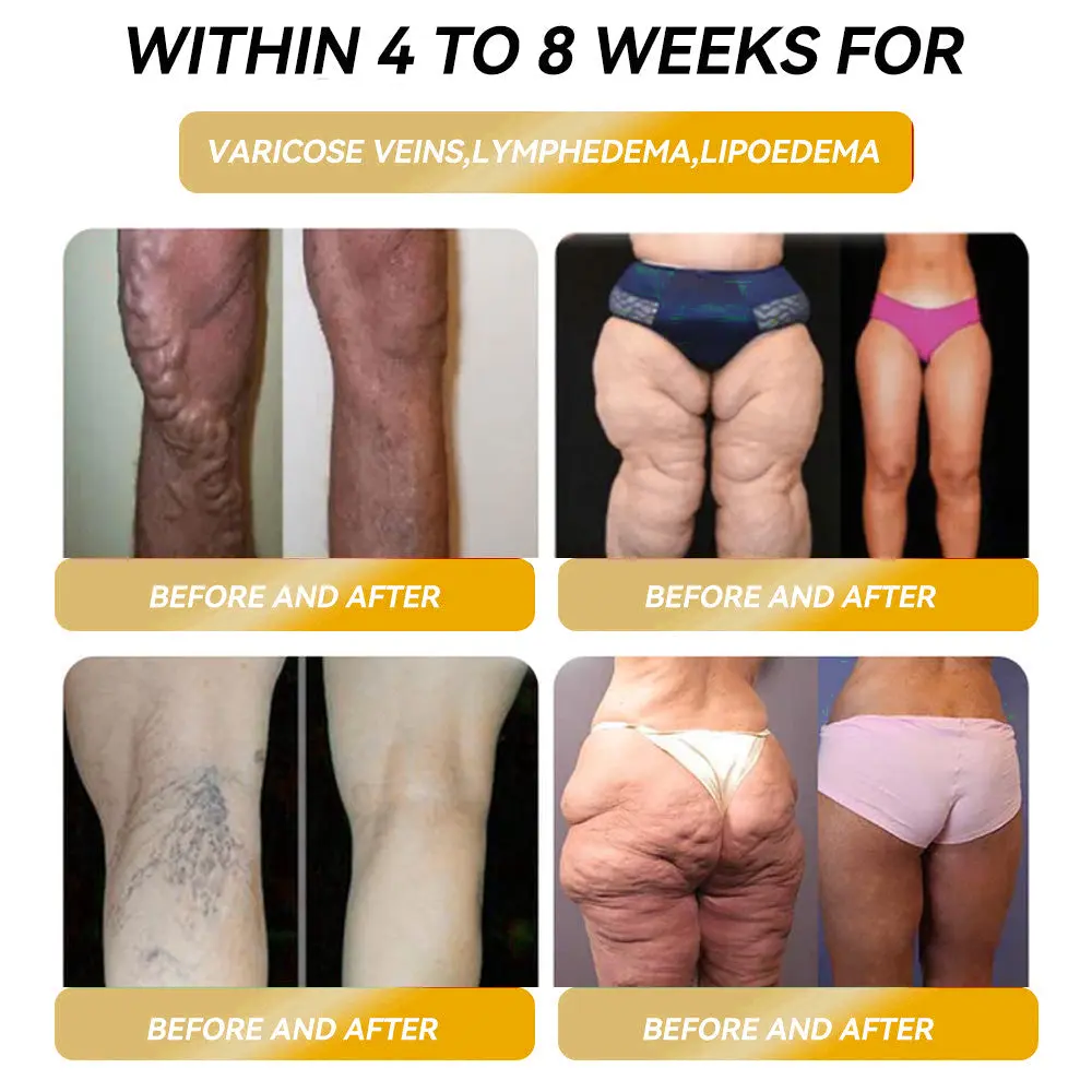 ๐๐๐๐๐๐๐ยฎ ๐๐๐ ๐ง๐๐ญ๐ข๐ ๐๐ง๐๐ซ๐ ๐ฒ ๐๐-๐๐ญ๐จ๐ง๐ ๐๐๐ฉ๐ฅ๐ ๐๐๐ซ๐ซ๐ข๐ง๐ ๐ฌ